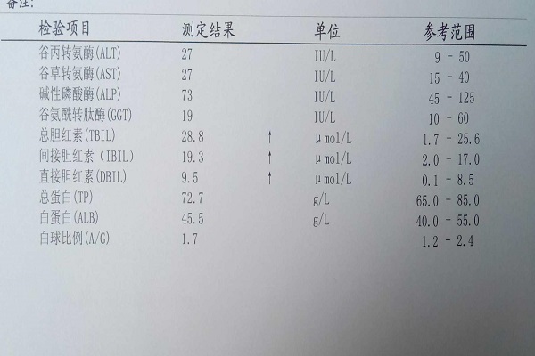 總膽紅素高是怎麼回事 總膽紅素高是什麼原因