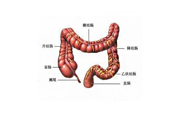 結腸癌的早期癥狀_結腸癌晚期癥狀及治療