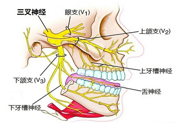 三叉神經痛癥狀_三叉神經痛怎麼治療_吃什麼藥