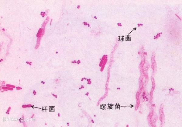 加特納菌性陰道炎是一種怎樣的疾病？