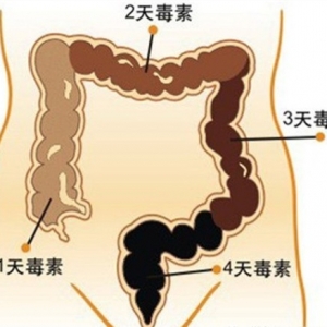 幾個清除宿便的偏方