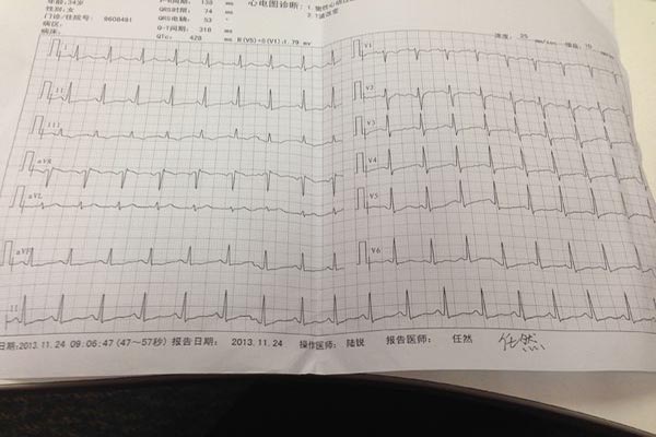 竇性心動過速的原因 竇性心動過速會猝死嗎