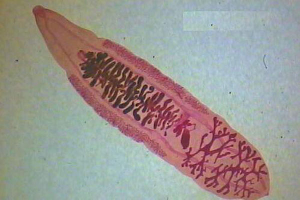 肝吸蟲病癥狀_肝吸蟲的治療方法_怎麼治療
